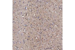 IHC analysis of SFXN5 using anti-SFXN5 antibody (ABIN7601388). (Sideroflexin 5 anticorps  (AA 34-340))