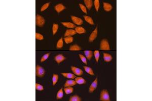 Immunofluorescence analysis of L929 cells using LY6E Rabbit pAb (ABIN6131998, ABIN6143391, ABIN6143392 and ABIN6214390) at dilution of 1:100 (40x lens).