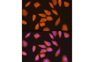 Immunofluorescence analysis of L929 cells using LY6E Rabbit pAb (ABIN6131998, ABIN6143391, ABIN6143392 and ABIN6214390) at dilution of 1:100 (40x lens). (LY6E anticorps  (AA 21-101))