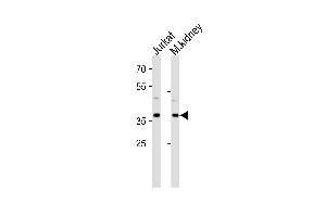 PK14 Antibody  (ABIN391332 and ABIN2841360) western blot analysis in Jurkat cell line and mouse kidney tissue lysates (35 μg/lane).