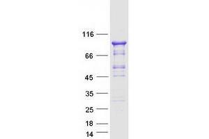 Validation with Western Blot