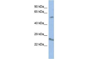 WB Suggested Anti-VENTX Antibody Titration:  0. (VENTX anticorps  (Middle Region))