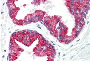 Human Prostate (formalin-fixed, paraffin-embedded) stained with KRT8 antibody ABIN292229 at 20 ug/ml followed by biotinylated anti-mouse IgG secondary antibody ABIN481714, alkaline phosphatase-streptavidin and chromogen. (KRT8 anticorps)