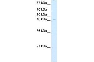 WB Suggested Anti-ZNF70 Antibody Titration:  5. (ZNF70 anticorps  (C-Term))