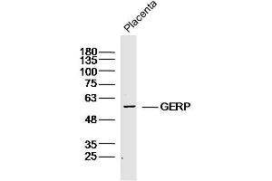 Mouse placenta lysates probed with GERP Polyclonal Antibody, Unconjugated  at 1:300 dilution and 4˚C overnight incubation. (TRIM8 anticorps)