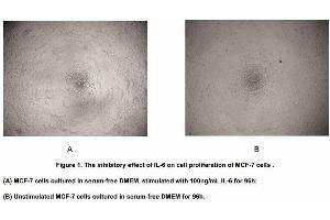 Interleukin 6 (IL6) (AA 30-212) (Active) protein (His tag)