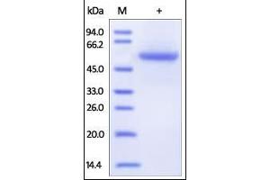 Human Carbonic Anhydrase IX (38-414), His Tag on SDS-PAGE under reducing (R) condition. (CA9 Protein (AA 38-414) (His tag))