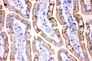 Anti- gamma Catenin Picoband antibody, IHC(F) IHC(F): Rat Intestine Tissue
