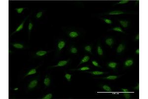 Immunofluorescence of monoclonal antibody to ZNF256 on HeLa cell. (ZNF256 anticorps  (AA 521-627))