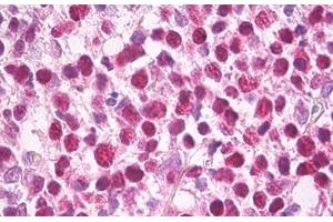 Anti-MCM5 antibody IHC staining of human tonsil. (MCM5 anticorps)