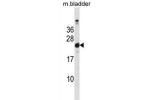 Mouse Hras1 Antibody (C-term) (ABIN1881438 and ABIN2838652) western blot analysis in mouse bladder tissue lysates (35 μg/lane). (HRAS anticorps  (C-Term))