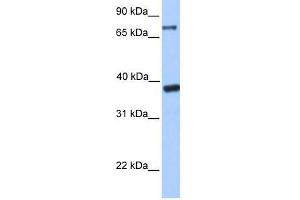 DIDO1 antibody used at 2. (DIDO1 anticorps  (C-Term))