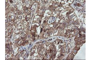 Image no. 5 for anti-Trafficking Protein Particle Complex 4 (TRAPPC4) antibody (ABIN1501265)