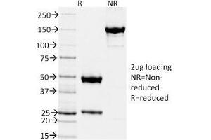 SDS-PAGE Analysis Purified TIMP2 Mouse Monoclonal Antibody (TIMP2/2044). (TIMP2 anticorps  (AA 48-220))
