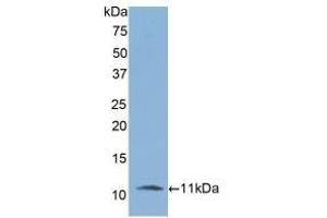Detection of Recombinant IL6R, Rat using Polyclonal Antibody to Interleukin 6 Receptor (IL6R) (IL-6 Receptor anticorps)