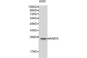 Western blot analysis of K562 cell lysate using RAB7A antibody. (RAB7A anticorps  (C-Term))