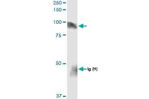Immunoprecipitation of HLCS transfected lysate using anti-HLCS MaxPab rabbit polyclonal antibody and Protein A Magnetic Bead , and immunoblotted with HLCS MaxPab rabbit polyclonal antibody (D01) .