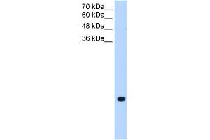 WB Suggested Anti-TMEM75 Antibody Titration:  0. (TMEM75 anticorps  (C-Term))