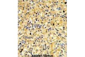 Immunohistochemistry (IHC) image for anti-Coiled-Coil Domain Containing 3 (CCDC3) antibody (ABIN3003893)