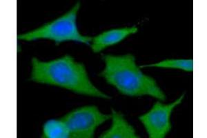ICC/IF analysis of HSP90 in HeLa cells line, stained with DAPI (Blue) for nucleus staining and monoclonal anti-human HSP90 antibody (1:100) with goat anti-mouse IgG-Alexa fluor 488 conjugate (Green).