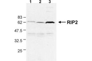 Detection of endogenous human RIP2 in different human cell lines by the MAb to RIP2 (Nick-1) . (RIP2 anticorps  (AA 1-322))