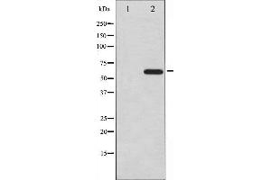 Western blot analysis of CDC25A expression in UV treated A2780 whole cell lysates,The lane on the left is treated with the antigen-specific peptide. (CDC25A anticorps  (N-Term))