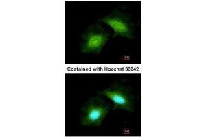 ICC/IF Image Immunofluorescence analysis of methanol-fixed HeLa, using GADD45 gamma, antibody at 1:200 dilution. (GADD45G anticorps  (C-Term))
