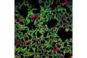 Bleomycin-induced lung injury in WT mice: Confocal images of untreated and bleomycin-treated WT lung stained with antibodies against PDGFRβ and RAGE to illustrate fibrotic foci at sites of epithelial damage.