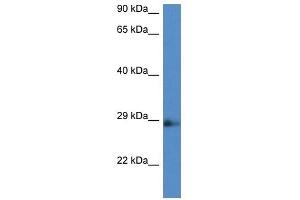 Western Blot showing Ard1b antibody used at a concentration of 1.
