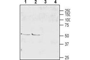 Western blot analysis of mouse (lanes 1 and 3) and rat (lanes 2 and 4) brain lysate: - 1,2. (SLC1A6 anticorps  (2nd Extracellular Loop))