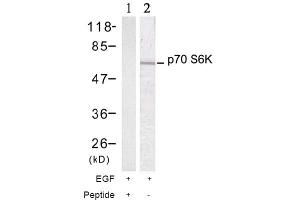 Image no. 2 for anti-Ribosomal Protein S6 Kinase, 70kDa, Polypeptide 1 (RPS6KB1) (Thr389) antibody (ABIN197397) (RPS6KB1 anticorps  (Thr389))