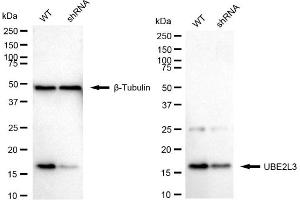 Western blotting analysis using UBE2L3 antibody (ABIN7800748).