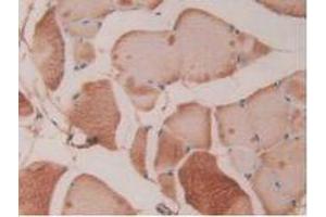 IHC-P analysis of Rat Skeletal Muscle Tissue, with DAB staining. (Fibrillin 1 anticorps  (AA 751-895))