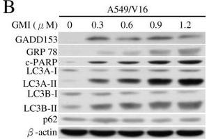 Analyses of GMI, TG and TM regulated ER stress, apoptosis and autophagy by Western blotting.