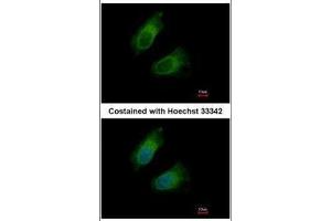 ICC/IF Image Immunofluorescence analysis of methanol-fixed HeLa, using GOT2, antibody at 1:500 dilution. (GOT2 anticorps  (Center))
