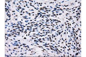 Image no. 13 for anti-Replication Protein A2, 32kDa (RPA2) antibody (ABIN1500736) (RPA2 anticorps)