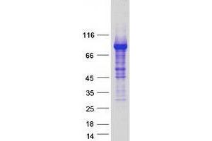 Validation with Western Blot (ZBTB16 Protein (Transcript Variant 1) (Myc-DYKDDDDK Tag))