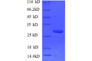 SDS-PAGE (SDS) image for Nucleoporin 153kDa (NUP153) (AA 657-880) protein (His tag) (ABIN5710031)