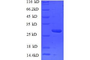 SDS-PAGE (SDS) image for Nucleoporin 153kDa (NUP153) (AA 657-880) protein (His tag) (ABIN5710031) (NUP153 Protein (AA 657-880) (His tag))