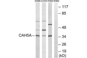 Western Blotting (WB) image for anti-Carbonic Anhydrase VA (CA5A) (Internal Region) antibody (ABIN1851008) (CA5A anticorps  (Internal Region))