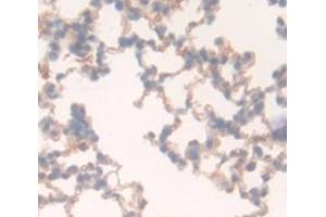 Used in DAB staining on fromalin fixed paraffin- embedded Kidney tissue (FLT1 anticorps  (AA 18-308))