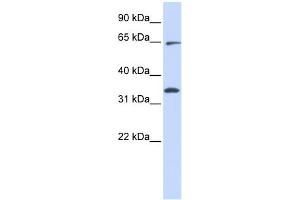 WB Suggested Anti-RHOT1 Antibody Titration:  0. (RHOT1 anticorps  (Middle Region))