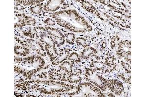 IHC analysis of TRIM24 using anti-TRIM24 antibody (ABIN7602358). (TRIM24 anticorps  (AA 706-964))