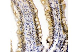 IHC analysis of CRY1 using anti-CRY1 antibody (ABIN3042761). (CRY1 anticorps  (N-Term))