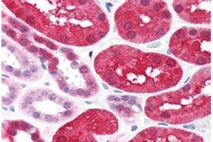 Human Kidney (formalin-fixed, paraffin-embedded) stained with XIAP antibody ABIN214586 at 2 ug/ml followed by biotinylated goat anti-rabbit IgG secondary antibody ABIN481713, alkaline phosphatase-streptavidin and chromogen. (XIAP anticorps  (C-Term))
