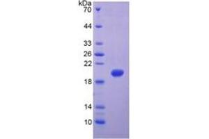 SDS-PAGE of Protein Standard from the Kit (Highly purified E.