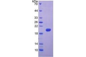 SDS-PAGE of Protein Standard from the Kit (Highly purified E. (MMP 9 Kit ELISA)