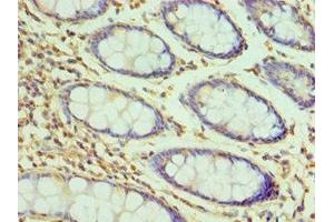 Immunohistochemistry of paraffin-embedded human colon tissue using ABIN7155385 at dilution of 1:100 (H2AFZ anticorps  (AA 1-128))