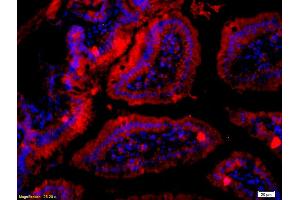 Formalin-fixed and paraffin embedded mouse intestine labeled with Anti- RET Polyclonal Antibody, Unconjugated (ABIN680788) at 1:200 followed by conjugation to the secondary antibody Goat Anti-Rabbit IgG, Cy3 conjugated used at 1:200 dilution for 40 minutes at 37°C and DAPI staining