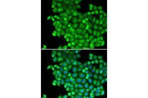 Immunofluorescence analysis of A549 cell using LDHA antibody. (Lactate Dehydrogenase A anticorps  (AA 1-332))